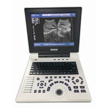 Фантомный мобильный сканер XF30B для биометрии плода, Ультразвуковое оборудование для терапии